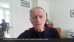Tuberculosis on the rise in parts of Canada News Clip
