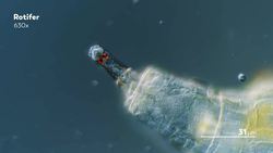 We Upgraded Our Microscope! Instructional Video