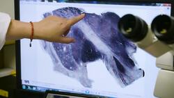 Inside the Harvard Brain Bank, Pioneering Neuroscience Research Instructional Video