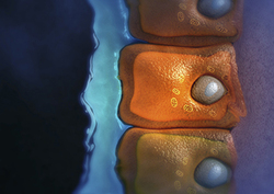 Cystic Fibrosis Instructional Video