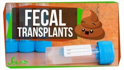 Why You Might Want Someone Else's Poop Inside You Instructional Video