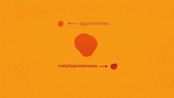 TED-Ed: Why haven't we cured arthritis? | Kaitlyn Sadtler and Heather J. Faust Instructional Video