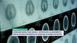 New Alzheimer's drug shown to reduce memory loss for some patients Instructional Video
