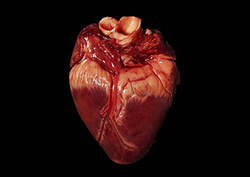 The Heart - Heart Basics Instructional Video