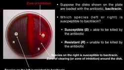 Disk Diffusion Test using Bacitracin or Optochin Instructional Video
