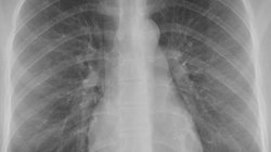 Radiological anatomy Instructional Video