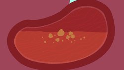 Bile and Emulsification Instructional Video