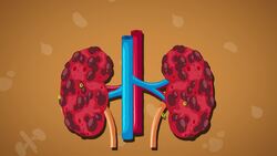 I WONDER - What Is Kidney Dialysis? Instructional Video