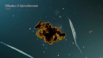 Dileptus: The Toxic Micro Elephant With an Insatiable Appetite