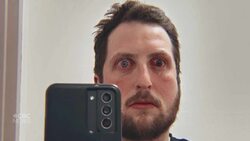 Regina drummer has eye pierced by broken drumstick at gig News Clip