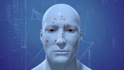 Measles cases on the rise across the country Instructional Video