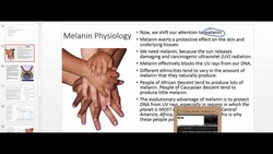 Melanin Physiology: Melanin Absoprtion of UV Light and Internal Conversion to Heat Instructional Video