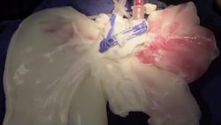 Technology helps create bio-engineered organs for human transplant Instructional Video