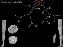 Sciatic nerve schematic Instructional Video