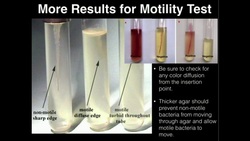 Microbiology: Motility Test Instructional Video