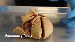 Understanding Heart Attacks: Anatomy, Physiology, and Mechanics Instructional Video