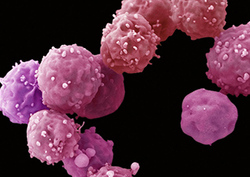 Células madre terapéuticas Instructional Video