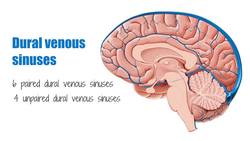 Inferior sagittal sinus Instructional Video