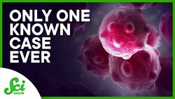 The Rarest Cancer in History (It's Also the Weirdest) Instructional Video