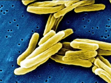 Prokaryotes: Bacteria in Action