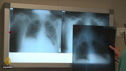 Kabul sees surge in hospitalisations after Taliban takeover News Clip