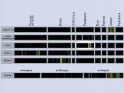 TED: Solving medical mysteries | Joe DeRisi Instructional Video