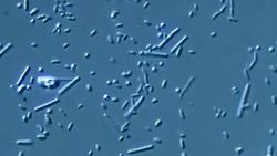 Why Do Bacteria Move Like Vibrating Chaos Snakes? Instructional Video