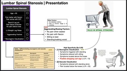Lumbar Spinal Stenosis | Presentation & Diagnosis Instructional Video