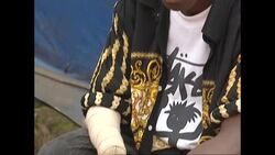 Residents in amputee camp following war News Clip