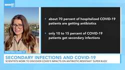 Secondary Infection Rarely Found In COVID-19 Patients News Clip