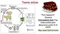 Tapeworms | Transmission, Symptoms, Diagnosis, Treatment & Prevention Instructional Video