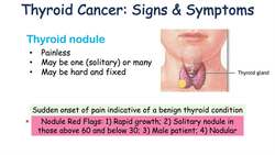 Thyroid Cancer Signs & Symptoms (& Why They Occur) Instructional Video