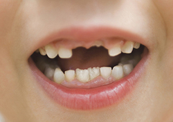 Factpack: Teeth Instructional Video