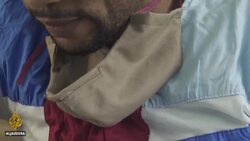 COVID-19 survivors in DR Congo speak of stigma News Clip