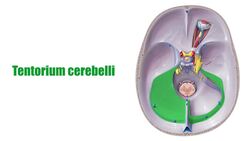 Tentorium cerebelli Instructional Video