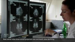 Canada gains ground against cancer, but progress is at risk News Clip
