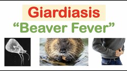 Giardiasis (Beaver Fever) Infection Sources, Pathophysiology, Signs & Symptoms, Diagnosis, Treatment Instructional Video
