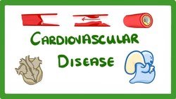 GCSE Biology - Why Do We Get Heart Disease and How to Treat It? - Cardiovascular Disease (CVD) #47 Instructional Video
