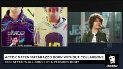 Dustin of "Stranger Things" on His Genetic Disorder News Clip