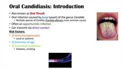 Oral Candidiasis (Oral Thrush) | Causes, Pathophysiology, Signs & Symptoms, Diagnosis, Treatment Instructional Video