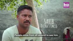 Boy With Hairy Tail Worshipped As God In India: BORN DIFFERENT Instructional Video