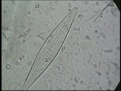 Protists: Euglenas, Diatoms, and Dinoflagellates Instructional Video