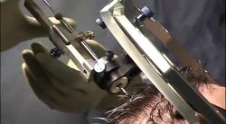 KS3/4 Science: Stem Cell Research: The Issue Instructional Video