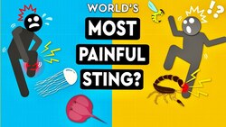 What's The Most Painful Sting You Can Survive Instructional Video