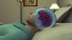 Sleep deprivation linked to increase in Alzheimer's protein Instructional Video