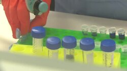 UK: Scientists at Liverpool School of Tropical Medicine testing samples of Covid-19 News Clip