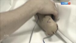 Her husband cut off her hands; she’s fighting for tougher domestic violence laws in Russia News Clip