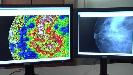 NASA | NASA Aids in Medical Imaging