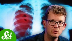 Why Is Lung Cancer in Non-smokers on the Rise? Instructional Video