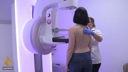UK: Millions miss cancer screening and treatment due to COVID-19 News Clip